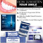 How To: Whiten Your Teeth